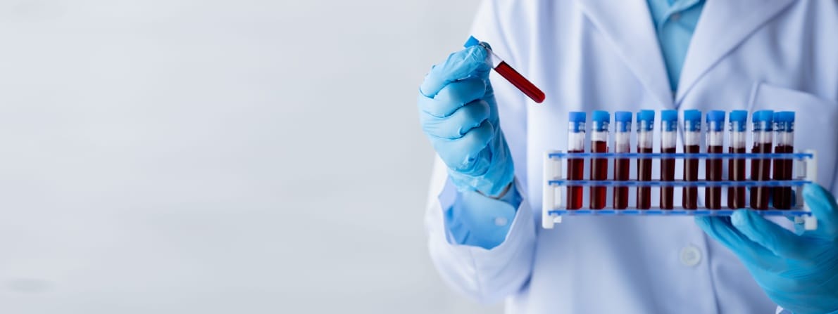 A scientist in a lab coat and blue gloves holds a test tube of blood and a rack of similar tubes, conveying a clinical, analytical atmosphere.